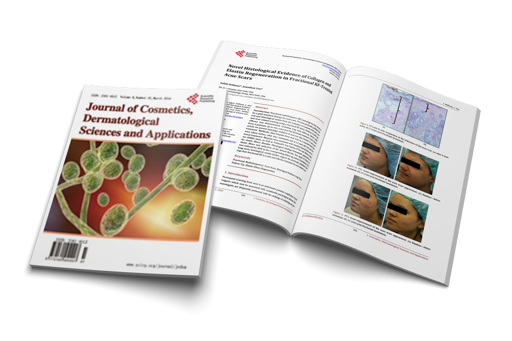 Novel Histological Evidence of Collagen and Elastin Regeneration in Fractional RF-Treated Acne Scars