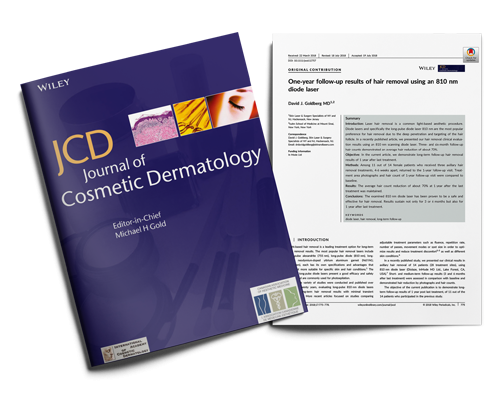 1-year Follow-up Diolaze 810 nm Diode Hair Removal