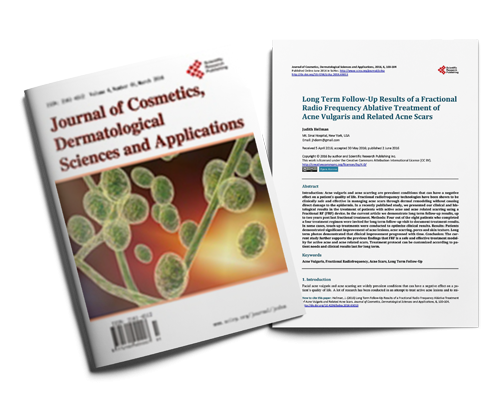 Long Term Follow-Up Results of a Fractional Radio Frequency Ablative Treatment of Acne Vulgaris and Related Acne Scars