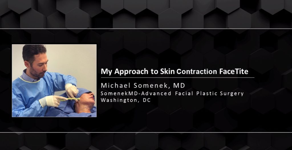 Webinar: FaceTite Skin Contraction Patient Case Studies - Dr. Michael Somenek