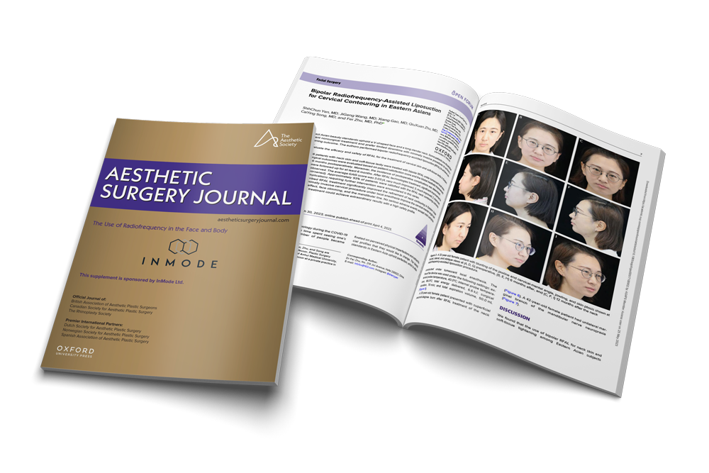 Jaw Contouring for Eastern Asian Patients using FaceTite