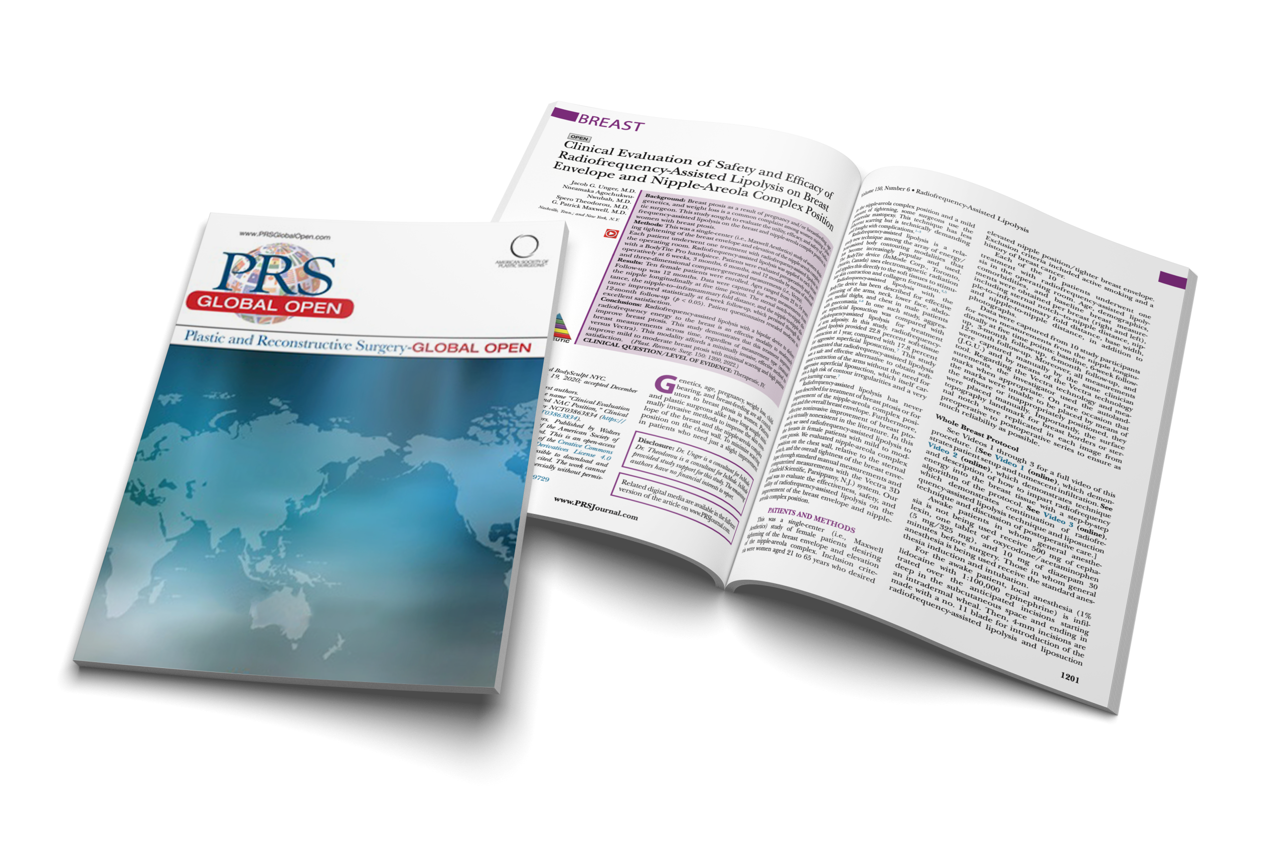 Clinical Evaluation of Safety and Efficacy of RFAL on Breast Envelope and Nipple-Areola Complex Position