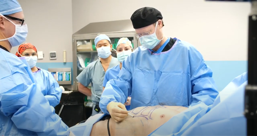 Live Demo: Male Body Contouring with BodyTite & Morpheus8 Body - Dr. Henry Mentz