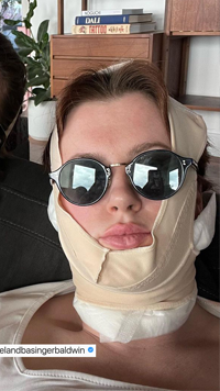 Ireland-Baldwin-FaceTite