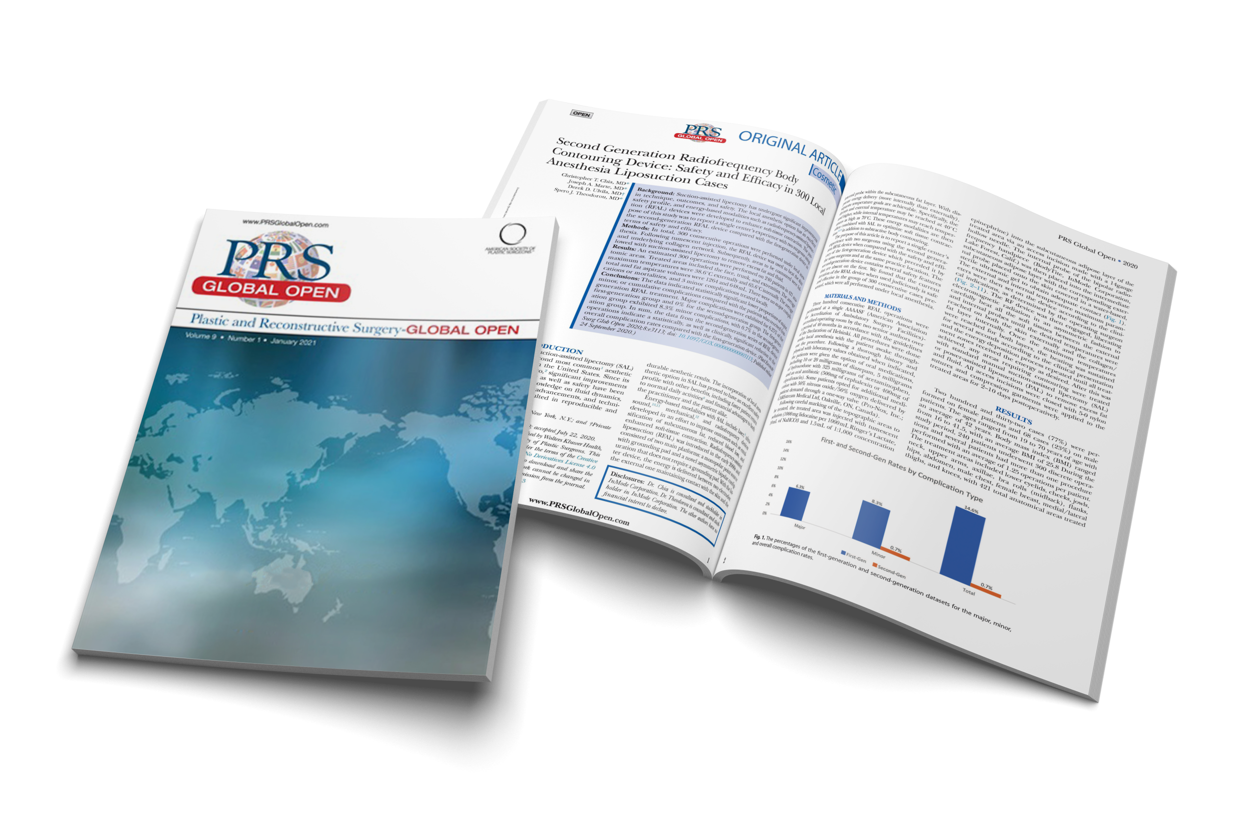 Second Generation Radiofrequency Body Contouring Device: Safety and Efficacy in 300 Local Anesthesia Liposuction Cases