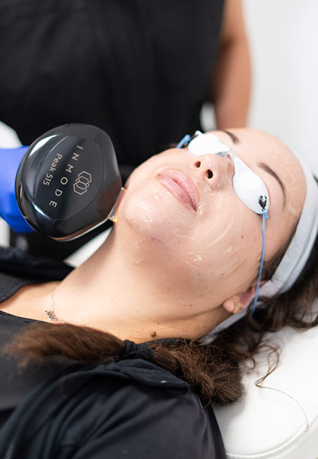 Lumecca IPL by InMode | Technology Resources & Training