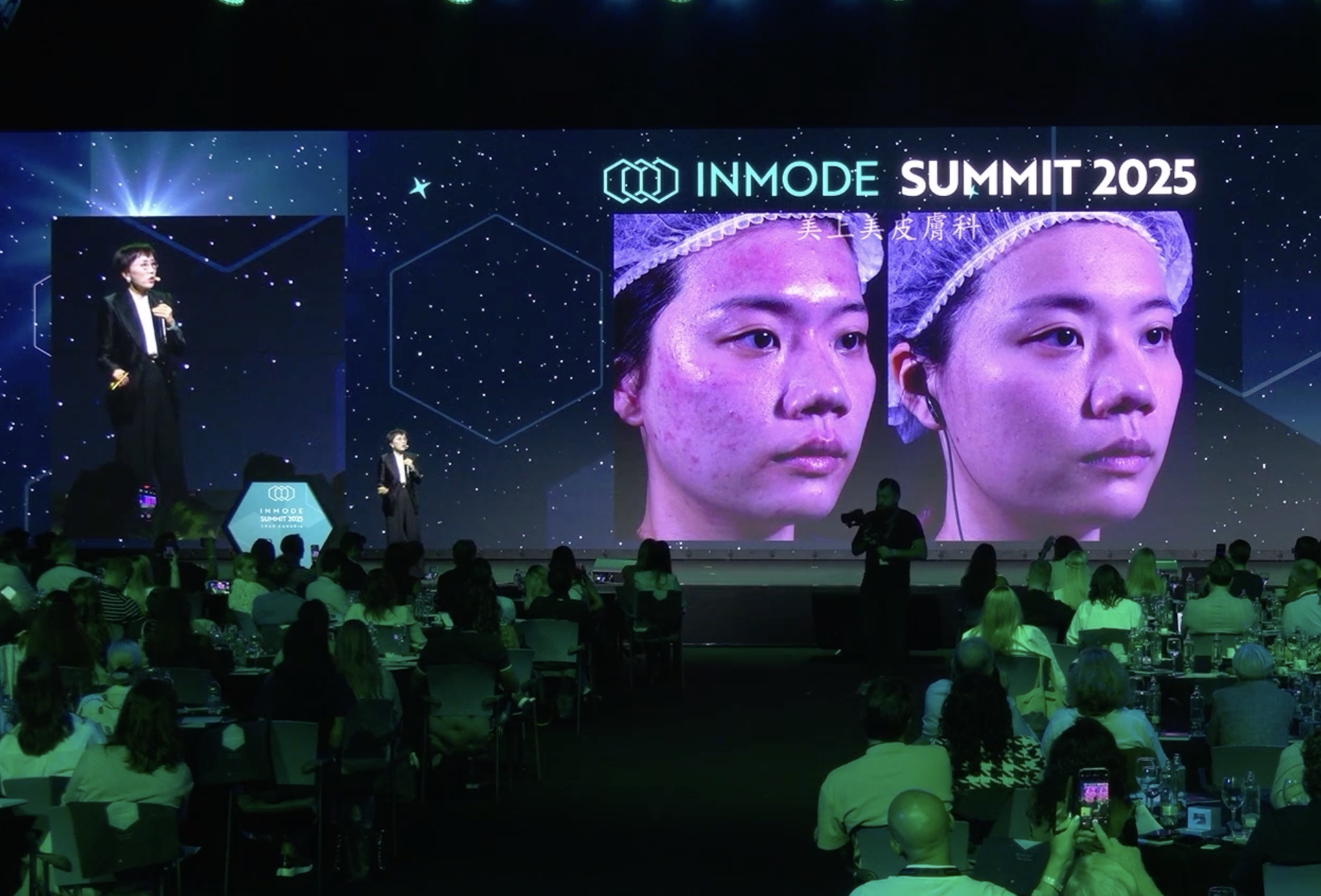 Webinar: Acne Management with Morpheus8 and Lasers Contribution – Dr. Celina Chuang