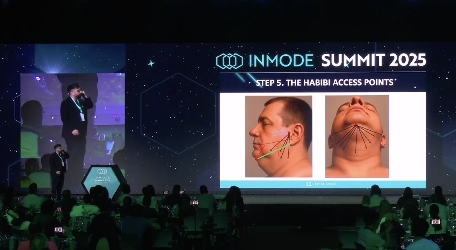 Luxora: Unlocking QuantumRF, Forma & Morpheus8 for Everyday Practice