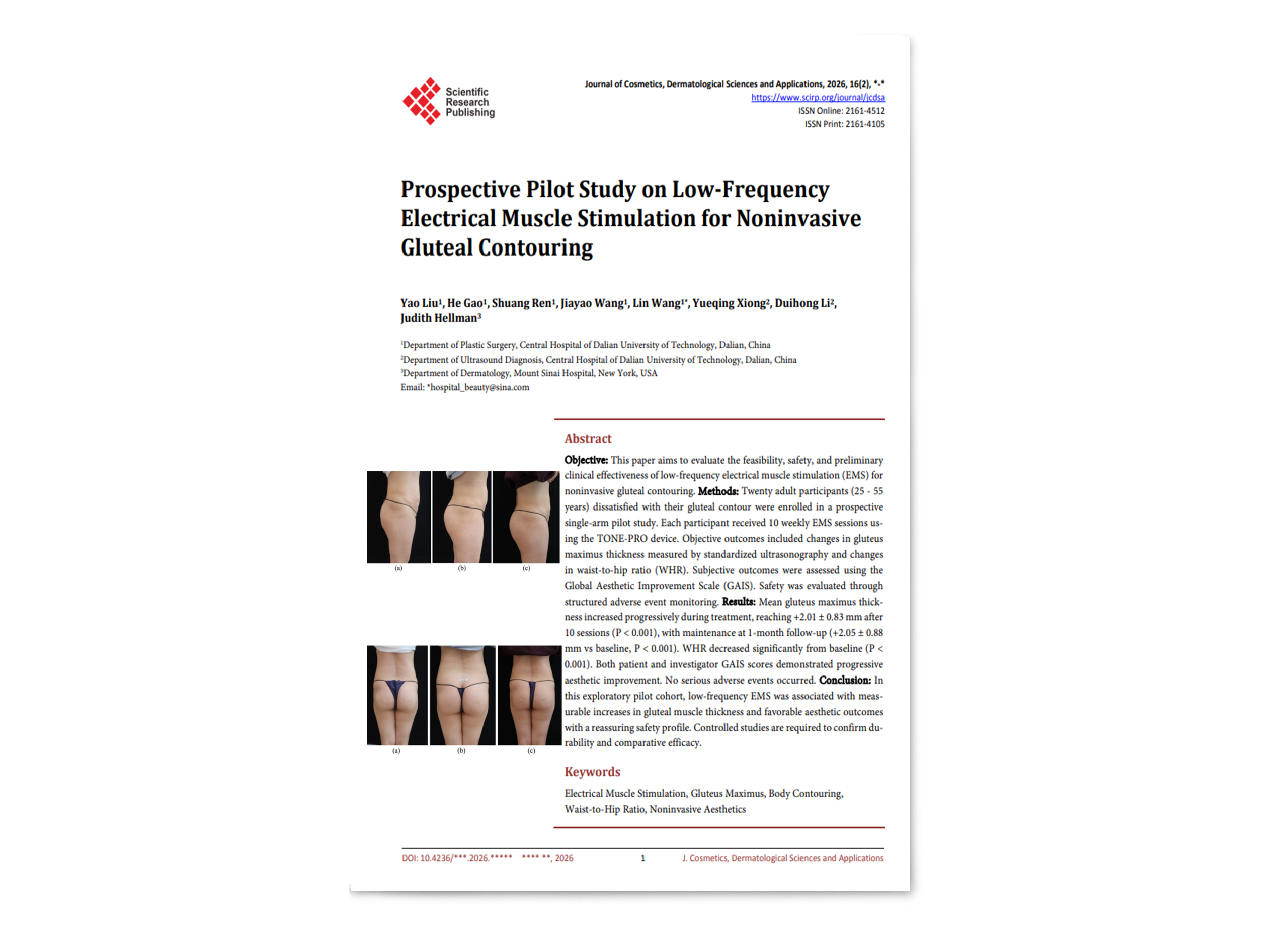 Prospective Pilot Study on Low-Frequency Electrical Muscle Stimulation for Noninvasive Gluteal Contouring